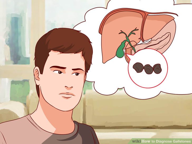 Những dấu hiệu nhận biết bệnh sỏi mật sớm nhất ai cũng phải nhớ - Ảnh 4. Những dấu hiệu nhận biết bệnh sỏi mật sớm nhất ai cũng phải nhớ - Ảnh 4.