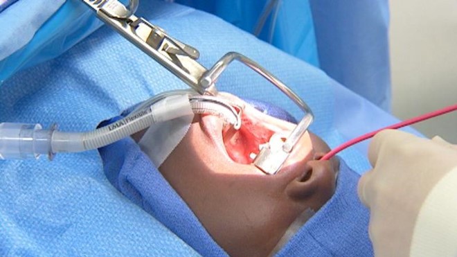 Biến chứng nguy hiểm có thể xảy ra khi cắt amidan - Ảnh 1. Biến chứng nguy hiểm có thể xảy ra khi cắt amidan - Ảnh 1.