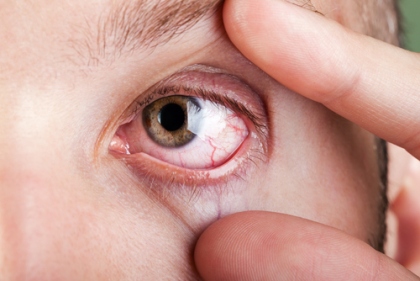 Mắt có một trong các dấu hiệu này, hãy cảnh giác nguy cơ mắc 9 loại bệnh nguy hiểm - Ảnh 2.