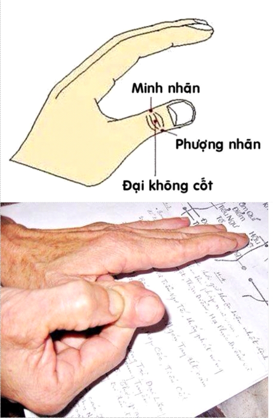 Giáo sư Đông y dạy cách làm sáng mắt cho người gần mù - Ảnh 3