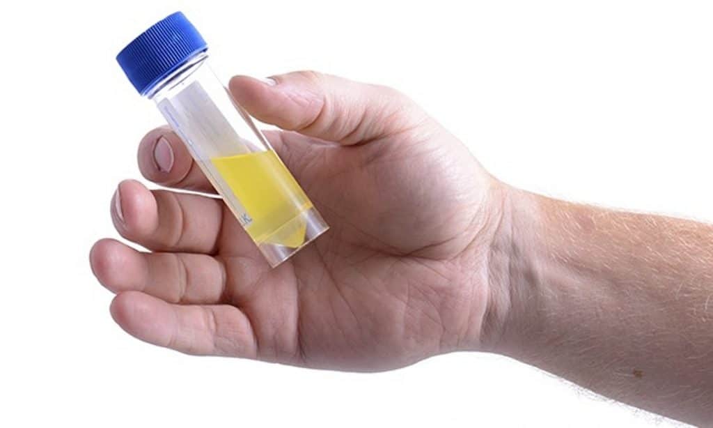 Nước tiểu có bọt: Dấu hiệu báo động không thể bỏ qua - Ảnh 4. Nước tiểu có bọt: Dấu hiệu báo động không thể bỏ qua - Ảnh 4.