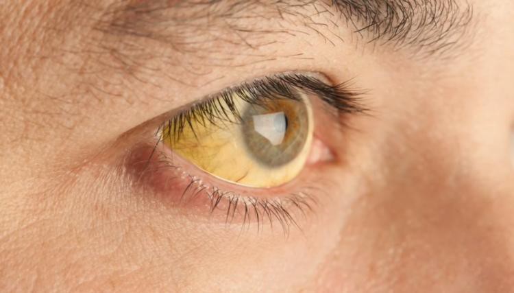 Cứ 3 người lại có 1 người không biết gì về căn bệnh ung thư rất nguy hiểm này - Ảnh 2. Cứ 3 người lại có 1 người không biết gì về căn bệnh ung thư rất nguy hiểm này - Ảnh 2.