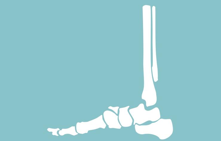 8 dấu hiệu đầu tiên của ung thư phổi thường bị bỏ qua: Biết sớm để phòng nguy hiểm - Ảnh 4. 8 dấu hiệu đầu tiên của ung thư phổi thường bị bỏ qua: Biết sớm để phòng nguy hiểm - Ảnh 4.