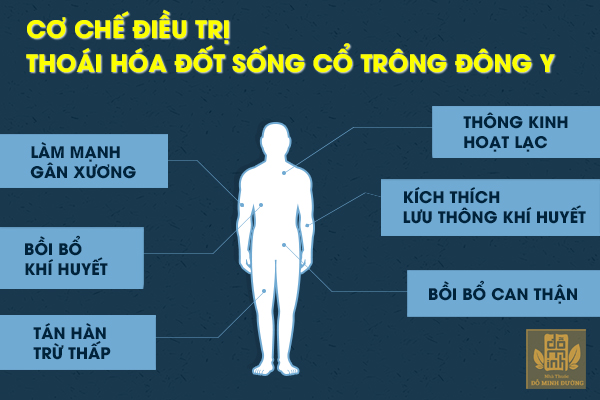 Thoái hóa đốt sống cổ: Nguyên nhân, triệu chứng và cách điều trị hiệu quả - Ảnh 3. Thoái hóa đốt sống cổ: Nguyên nhân, triệu chứng và cách điều trị hiệu quả - Ảnh 3.