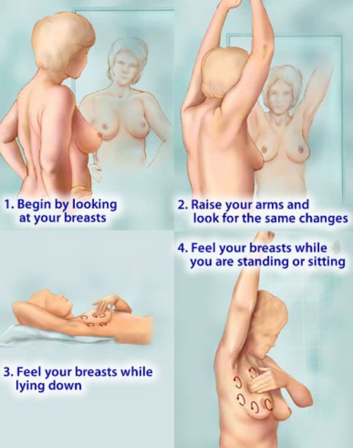 BS cảnh báo nhiều trường hợp 20 tuổi đã mắc ung thư vú: 4 bước tự khám vú phụ nữ cần biết - Ảnh 2.