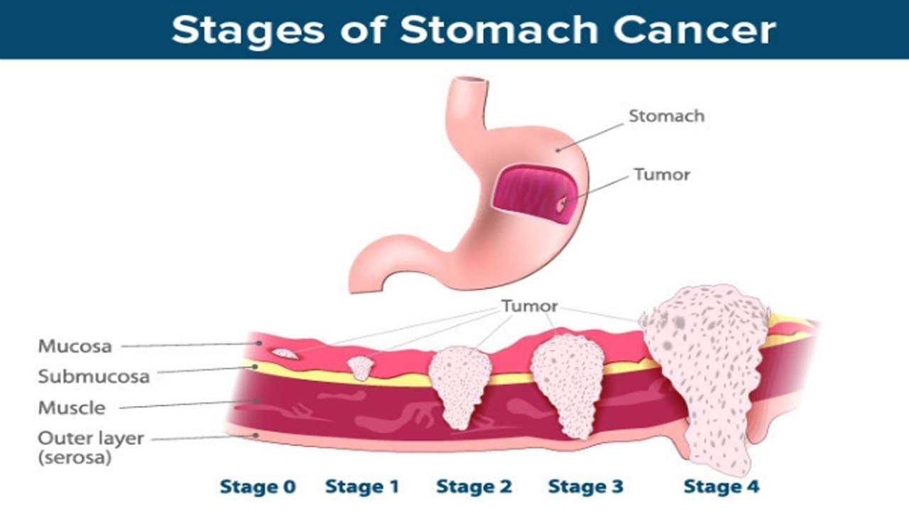 See stomach