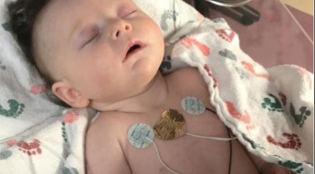 Hình ảnh em bé 7 tuần tuổi co giật, chảy máu não cho thấy vì sao luôn cần bảo vệ thóp trẻ sơ sinh thật cẩn thận - Ảnh 2.