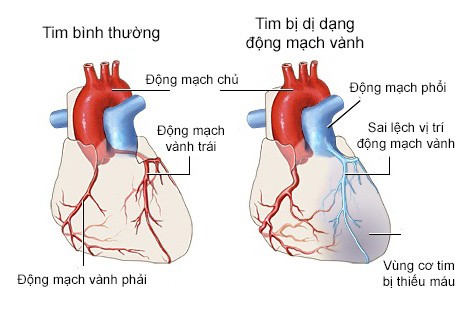 Hà Nội: Ăn sáng xong, lăn ra bất tỉnh ở chợ vì mắc nhóm bệnh gây tử vong cao nhất - Ảnh 1.