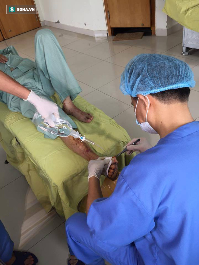 Hà Nội: Bác sĩ phải cắt lọc thịt bàn chân hoại tử cứu sống bệnh nhân tự ý chữa tiểu đường - Ảnh 1.