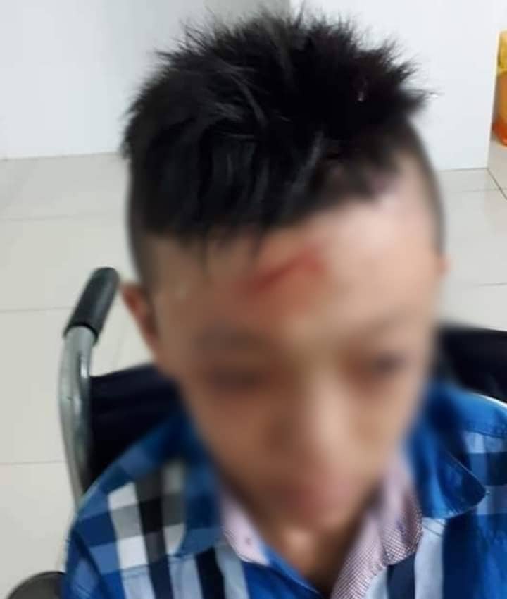 Nam sinh lớp 7 bị bạn đánh, đập đầu vào cửa kính chấn thương ngay tại trường học - Ảnh 2. Nam sinh lớp 7 bị bạn đánh, đập đầu vào cửa kính chấn thương ngay tại trường học - Ảnh 2.