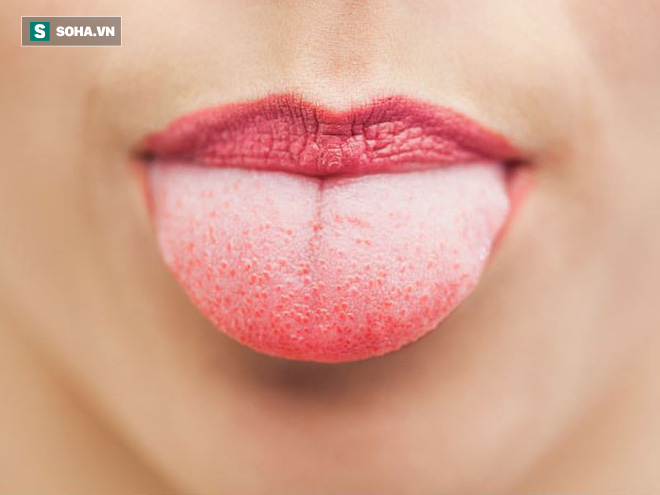 10 bộ phận bẩn nhất trên cơ thể: Nhiều người không thể đếm nổi hoặc điểm danh sai - Ảnh 1. 10 bộ phận bẩn nhất trên cơ thể: Nhiều người không thể đếm nổi hoặc điểm danh sai - Ảnh 1.