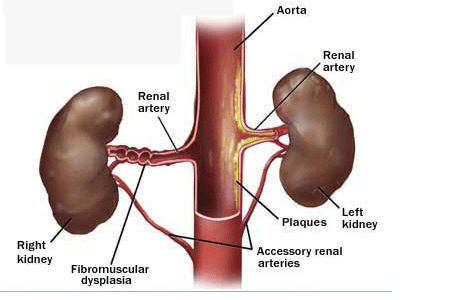 Corticosteroid hormone glucocorticoid