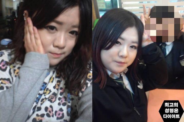 Những hình ảnh trước khi giảm cân của cô gái Hàn.