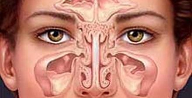 Viêm mũi xoang lâu năm, có thể trị dứt bằng thảo dược này Viêm mũi xoang lâu năm, có thể trị dứt bằng thảo dược này