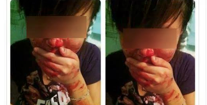 Kinh hoàng nữ sinh Hải Dương đăng ảnh lấm máu để... xin lỗi mẹ Kinh hoàng nữ sinh Hải Dương đăng ảnh lấm máu để... xin lỗi mẹ
