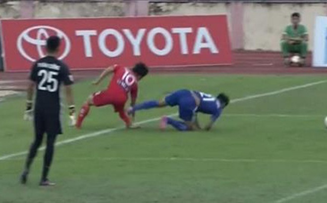 HLV HALG chính thức tiết lộ tình hình chấn thương của Công Phượng