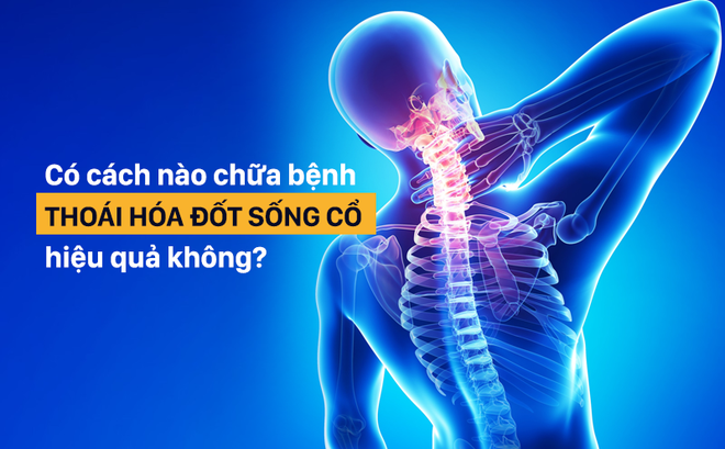 Giải pháp chữa bệnh thoái hóa đốt sống cổ: Kể cả khi chưa mắc bệnh cũng nên tham khảo sớm Giải pháp chữa bệnh thoái hóa đốt sống cổ: Kể cả khi chưa mắc bệnh cũng nên tham khảo sớm