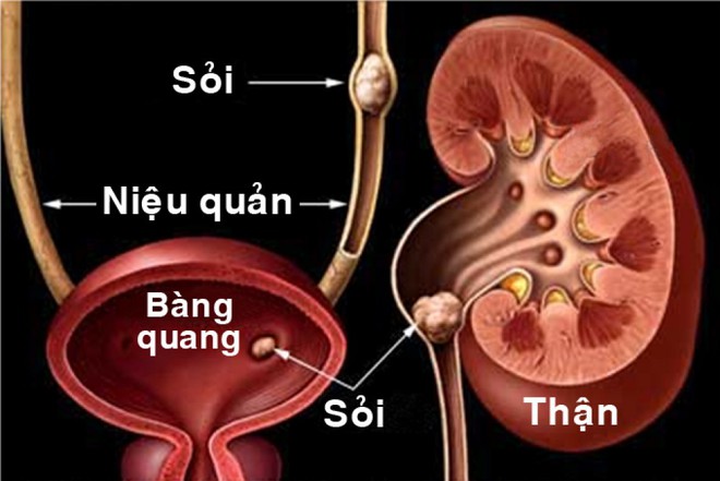 Danh y chia sẻ cách rửa sạch nội tạng: Không chỉ tôi, tất cả chúng ta đều nên làm ngay! - Ảnh 6.