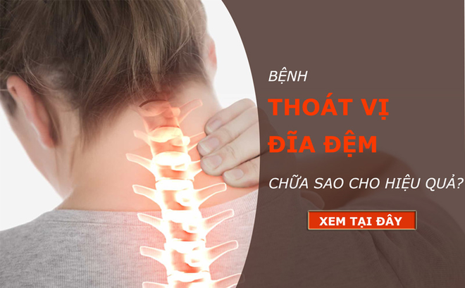 Thoát vị đĩa đệm là gì? Nguyên nhân, dấu hiệu và cách chữa bệnh hiệu quả nhất? Thoát vị đĩa đệm là gì? Nguyên nhân, dấu hiệu và cách chữa bệnh hiệu quả nhất?
