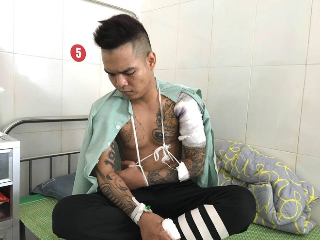 Đại ca giang hồ khai về khẩu súng colt dùng bắn thủng bụng đối thủ - Ảnh 3.