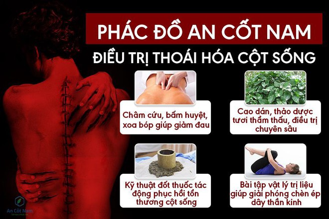 Thoái hóa cột sống là gì? Nguyên nhân, triệu chứng và cách chữa dứt điểm - Ảnh 4. Thoái hóa cột sống là gì? Nguyên nhân, triệu chứng và cách chữa dứt điểm - Ảnh 4.
