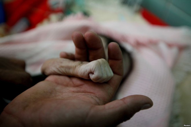 24h qua ảnh: Bà mẹ nắm tay con gái nhỏ tử vong do suy sinh dưỡng - Ảnh 3.