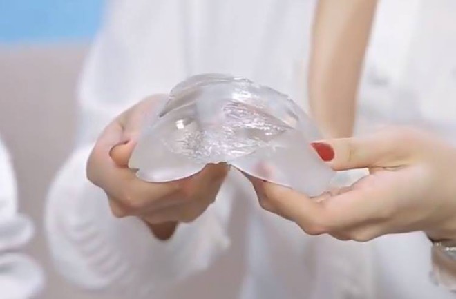 Bác sĩ Chiêm Quốc Thái nói về vụ nổ túi ngực trên máy bay - Ảnh 1. Bác sĩ Chiêm Quốc Thái nói về vụ nổ túi ngực trên máy bay - Ảnh 1.