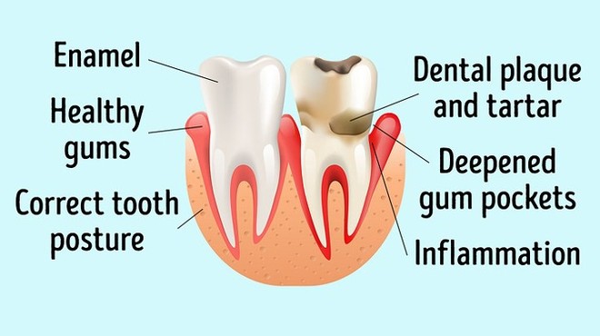  Dấu hiệu bệnh tim có thể được nhìn thấy bằng mắt thường - Ảnh 8.