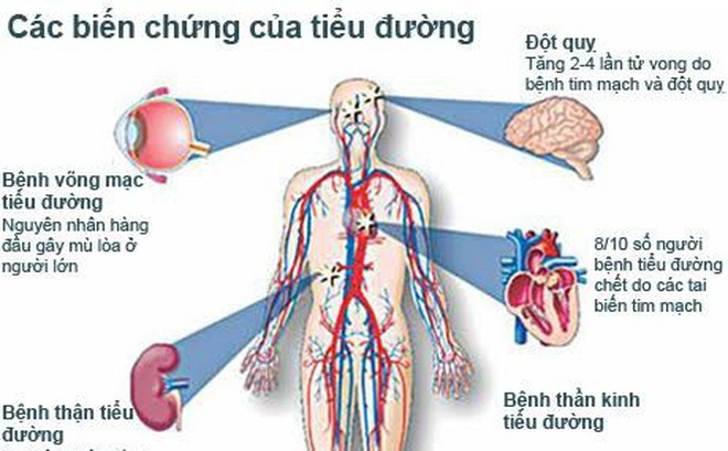 Những cơ quan bị ảnh hưởng nghiêm trọng do đái tháo đường