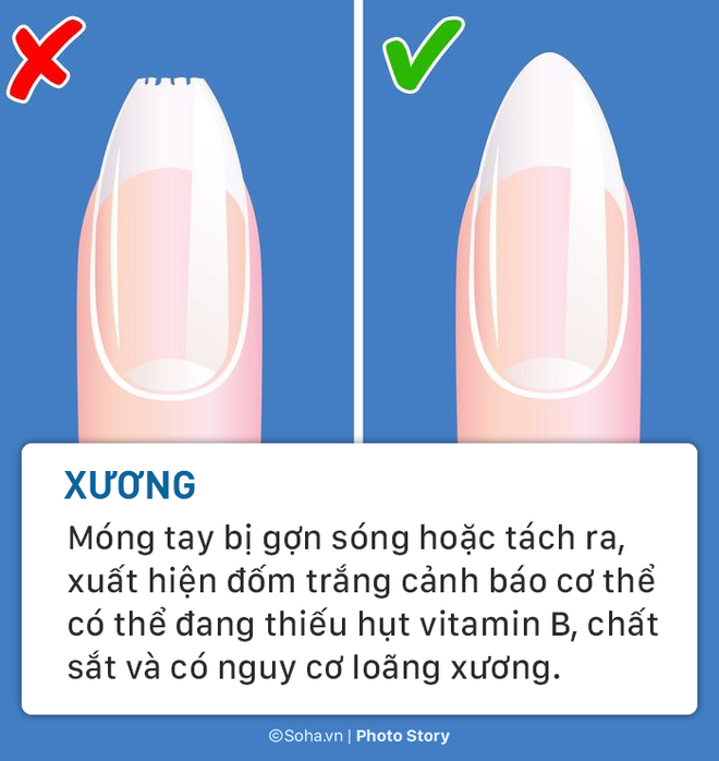 7 bài kiểm tra sức khỏe quan trọng bạn có thể tự thực hiện tại nhà - Ảnh 7.