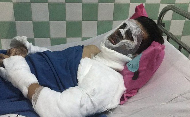 Vụ Việt kiều bị tạt axit, cắt gân chân: Người cha bất ngờ thông tin về 2 cuộc gọi của con trai cả