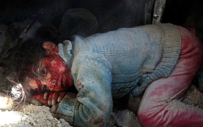 24h qua ảnh: Em bé Syria bị thương chờ được giải cứu - Ảnh 5.