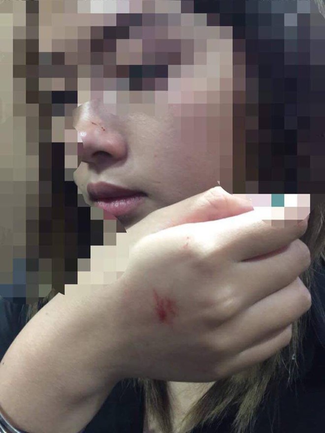 Cô gái bị ép hôn trong thang máy chung cư ở Hà Nội hé lộ danh tính yêu râu xanh - Ảnh 1.