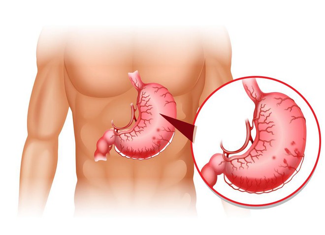 8 tác hại nghiêm trọng của rượu: Những giải pháp để hạn chế uống hoặc cai nghiện - Ảnh 4.