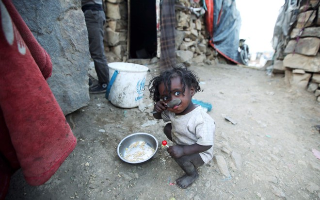 24h qua ảnh: Em bé Yemen ngồi ăn cơm tại khu ổ chuột - Ảnh 2.