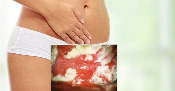 Влажные интимные салфетки Loovara купить со скидкой в секс шопе  Косметика  Интимная гигиена