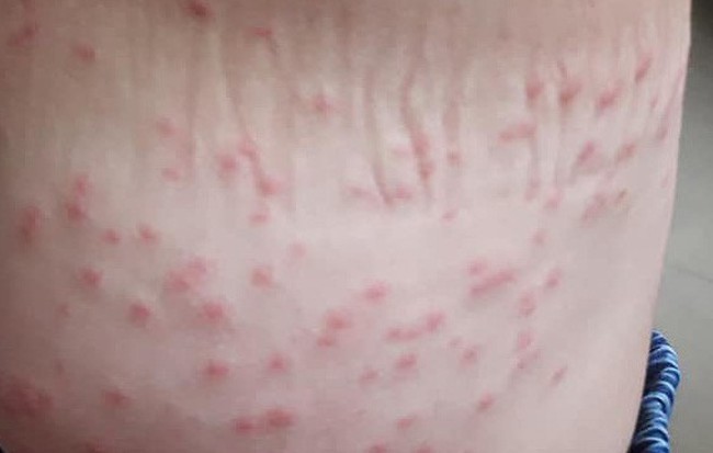 Nghi vấn nước biển Đà Nẵng gây ngứa cho người dân và du khách