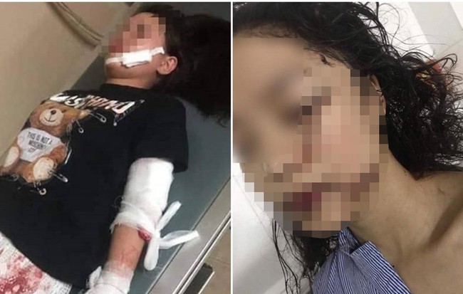 Những chi tiết rợn người qua lời kể của 2 cô gái tham gia vụ rạch mặt thiếu nữ xinh đẹp