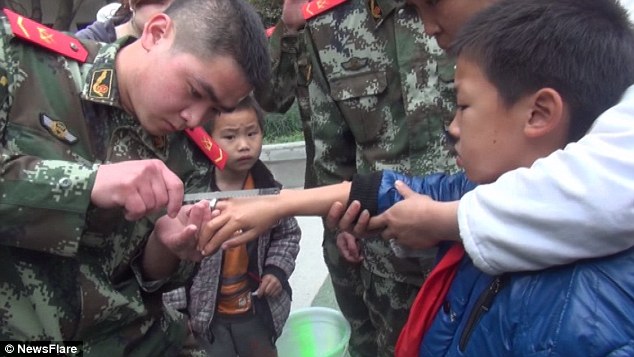 Một bé trai tại Trùng Khánh Trung Quốc đã nghịch dại đeo chiếc ốc vào tay mình và không thể lấy ra. Lính cứu họ đã dùng rất nhiều cách với hi vọng giải cứu cậu bé khỏi chiếc ốc càng ngày càng thắt chặt.