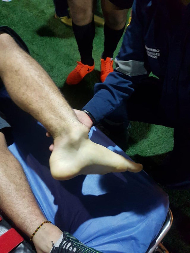 Hết hồn trước cảnh nam cầu thủ bị trật cổ chân ở vòng loại World Cup 2022 - Ảnh 1.
