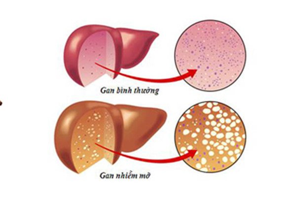 Chuối - Thực phẩm siêu năng lượng - Ảnh 3.