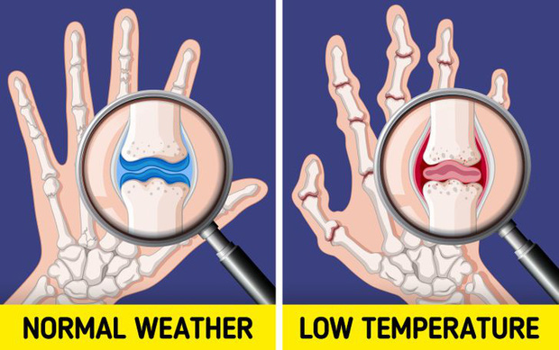 Đừng coi thường sưng tấy do nắng nóng hay da khô nứt nẻ vì giá lạnh, thời tiết có thể gây ra những tác hại đáng sợ thế này với cơ thể - Ảnh 6.
