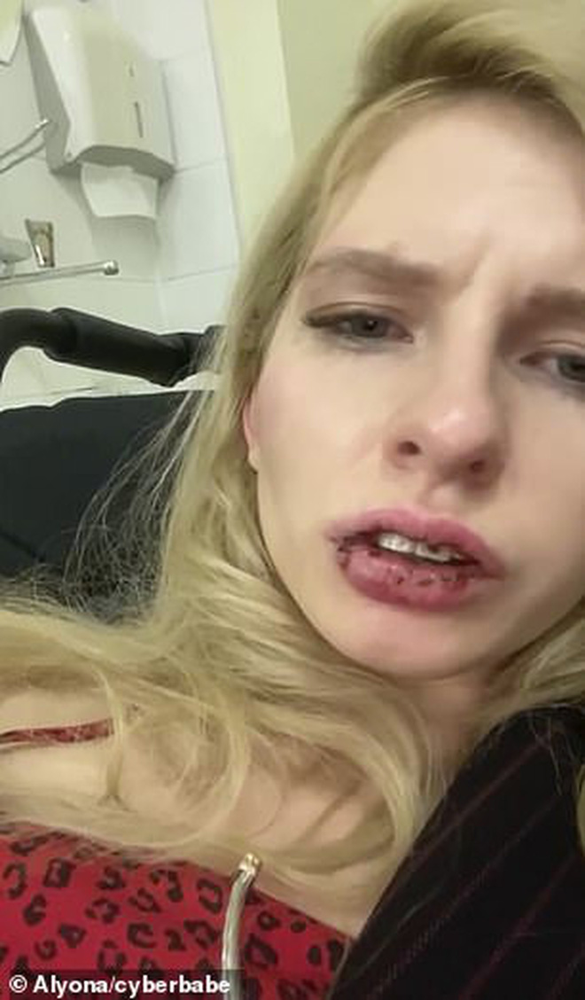Mẫu nữ bị đánh đập dã man đến gãy cả niềng răng khi đang livestream trên kênh YouTube có gần 700 nghìn subscriber - Ảnh 2.