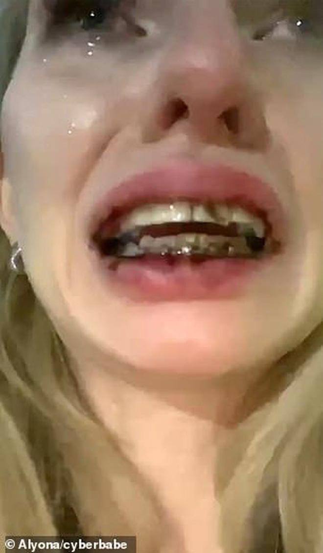 Mẫu nữ bị đánh đập dã man đến gãy cả niềng răng khi đang livestream trên kênh YouTube có gần 700 nghìn subscriber - Ảnh 4.