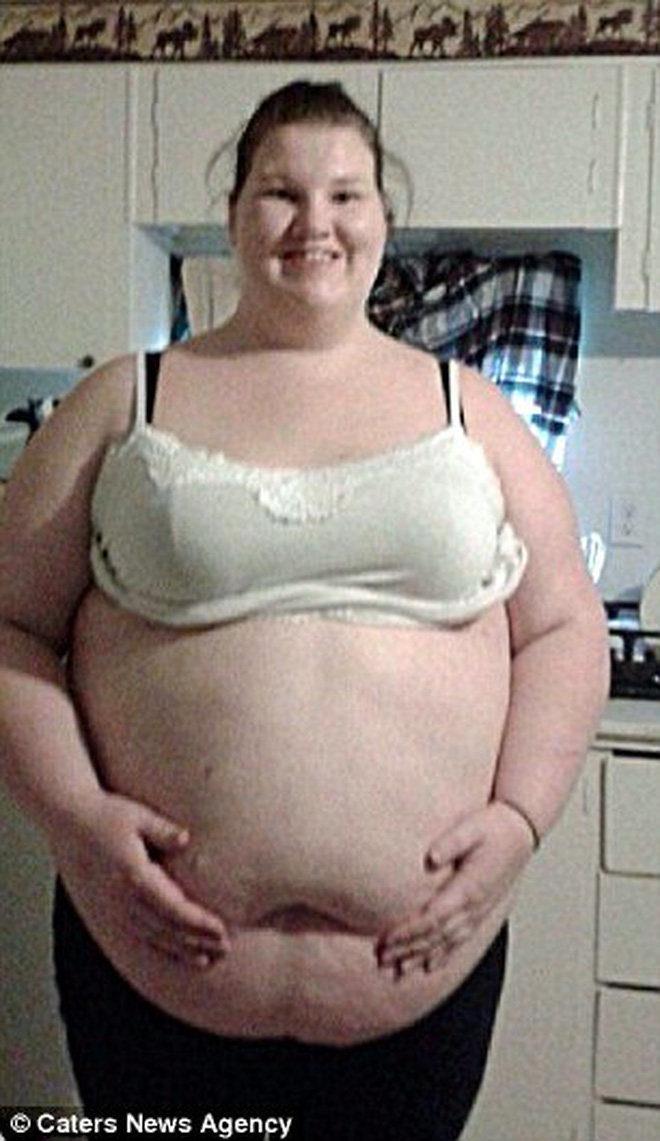 Bụng to như trống, người phụ nữ giảm liền 105kg trong vòng 1 tháng, nhìn vòng 2 sau giảm cân khiến nhiều người khiếp sợ không dám giảm cân cấp tốc nữa - Ảnh 3.