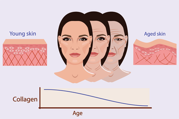 Vì sao nếp nhăn lại xuất hiện khi ta già đi? - Ảnh 1.