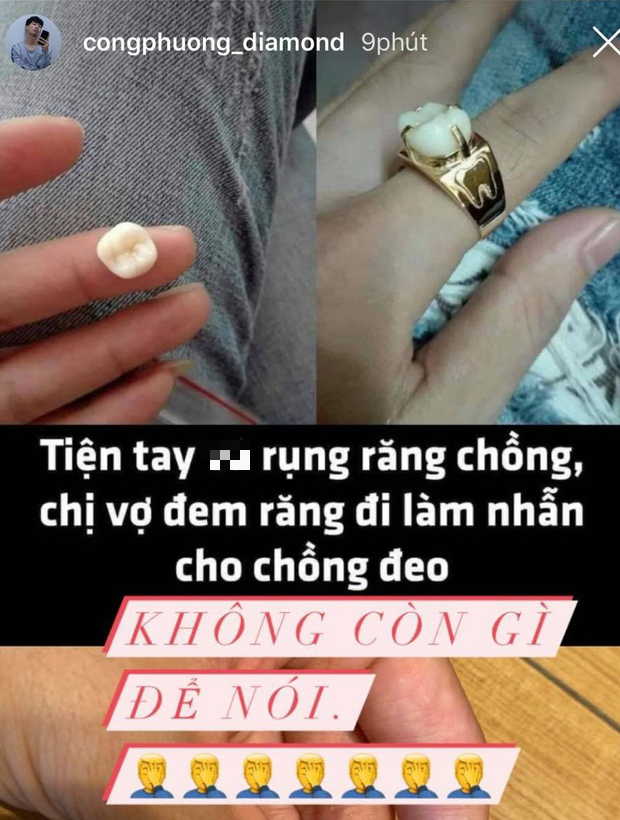 Công Phượng bình luận hài hước về sự việc vợ lấy răng chồng làm mặt nhẫn - Ảnh 1.