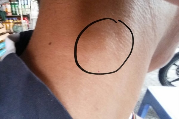 Sờ có hạch ở cổ, nam sinh 16 tuổi chết điếng vì mắc căn bệnh giống ông ngoại đã mất - Ảnh 1. Sờ có hạch ở cổ, nam sinh 16 tuổi chết điếng vì mắc căn bệnh giống ông ngoại đã mất - Ảnh 1.