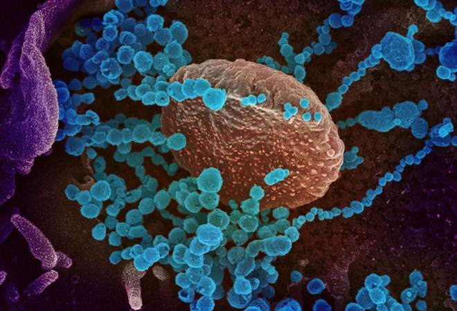 Phát hiện virus lây từ người sang người, gây cʜếᴛ chóc tại Bolivia: Dấy lên lo ngại bùng phát dịch bệnh mới! - Ảnh 1. Phát hiện virus lây từ người sang người, gây cʜếᴛ chóc tại Bolivia: Dấy lên lo ngại bùng phát dịch bệnh mới! - Ảnh 1.