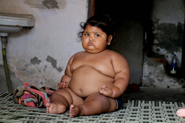 Cuộc sống của bé gái béo nhất thế giới từng khiến truyền thông phải ngỡ ngàng 3 năm trước giờ ra sao? - Ảnh 5.